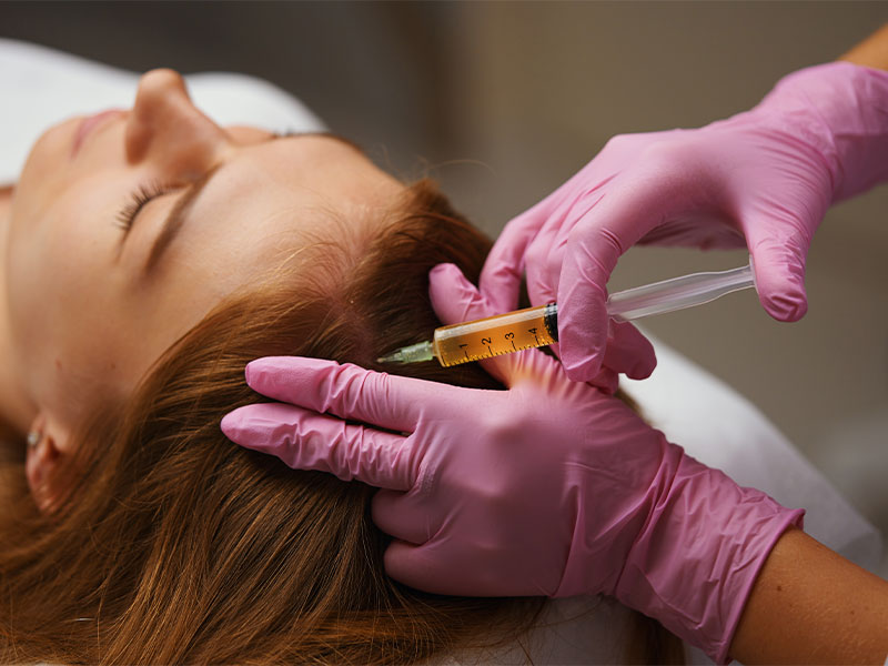 Exossomos Capilares: O Guia Completo sobre o Tratamento