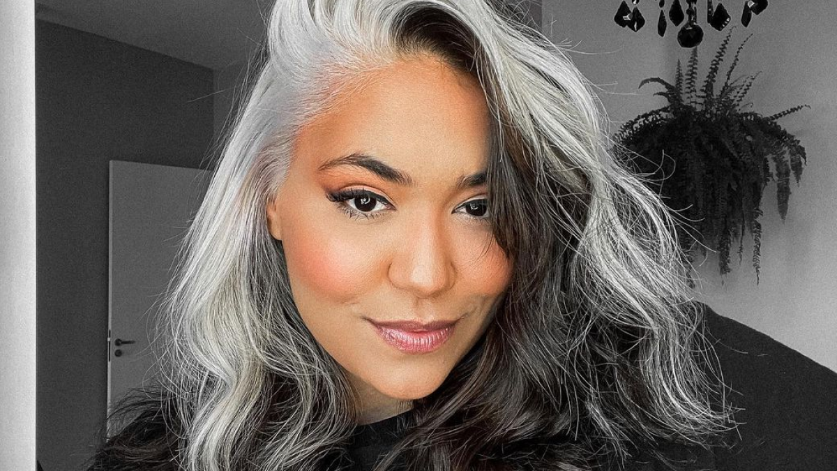 Piebaldismo: Entenda a Condição Genética da Mecha Branca Natural