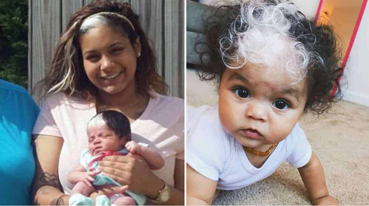 Deficiência de Vitaminas e o Surgimento Precoce de Fios Brancos: O que Você Precisa Saber