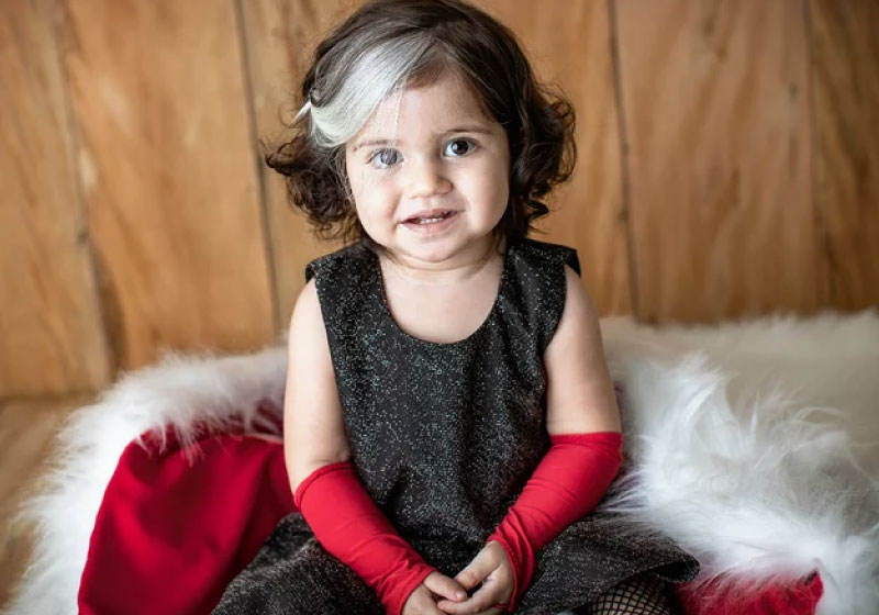 Mecha Branca: Tendência de Estilo ou Sinal de Saúde?