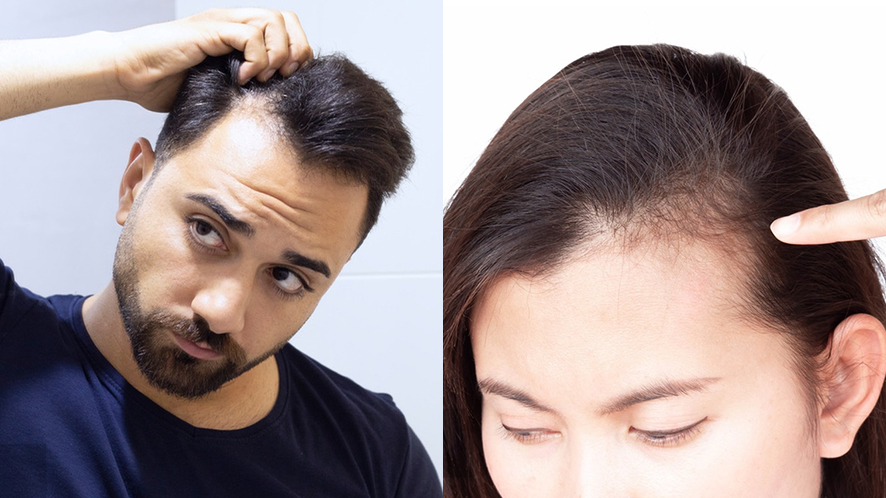 pico de viúva causas genéticas tratamento