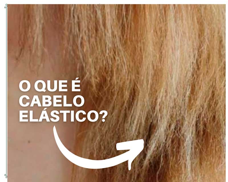 Cabelo Elástico O Que Fazer