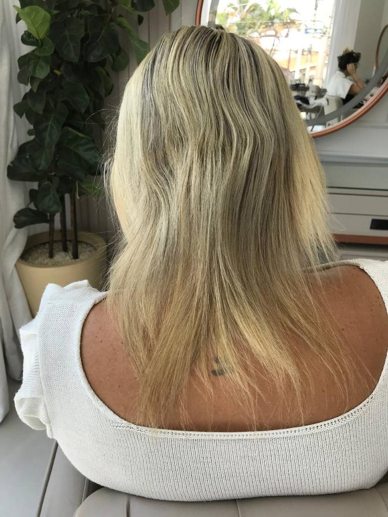 tratamento intensivo para corte quimico severo