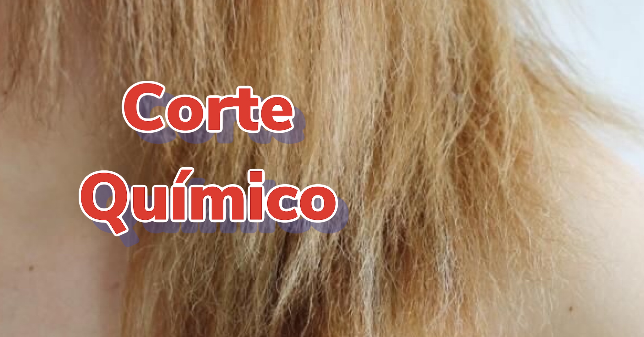 tratamento intensivo para corte quimico severo