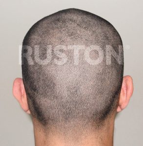 Erros Comuns ao Raspar o Cabelo em Casa e Como Evitá-los