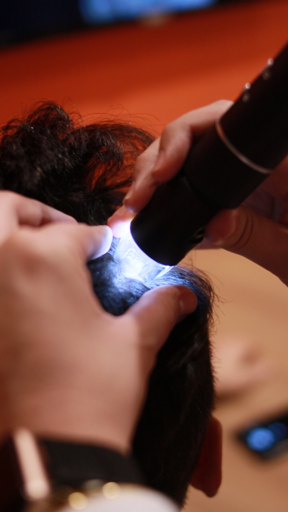 Clínica com robô de transplante capilar SP