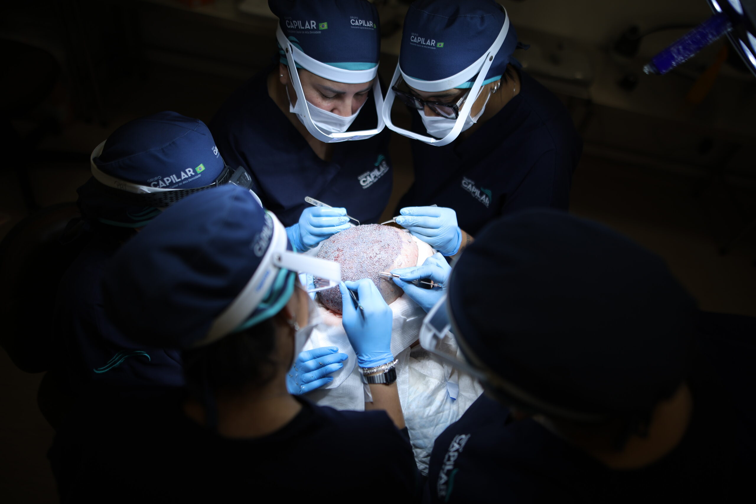 5 ideias de títulos:
1. Transplante Capilar Robótico vs. Manual: Qual a Melhor Escolha para Você?
2. Clínica Everin: Inovação e Exclusividade no Transplante Capilar Robótico em SP
3. Entenda o Processo e os Benefícios do Transplante Capilar com o Robô ARTAS
4. Guia Completo de Preços e Fatores que Influenciam o Custo do Transplante Capilar Robótico
5. Recuperação Pós-Transplante Capilar: Dicas Essenciais para Técnicas Robóticas e Manuais