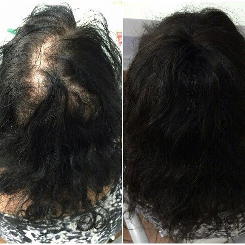 Guia Completo de Fibras de Queratina: Como Escolher e Aplicar