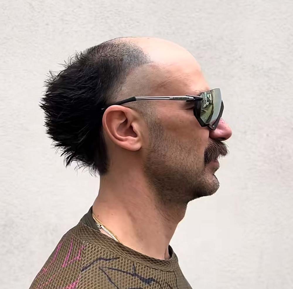 Como Escolher a Melhor Barbearia para Tratar a Calvície