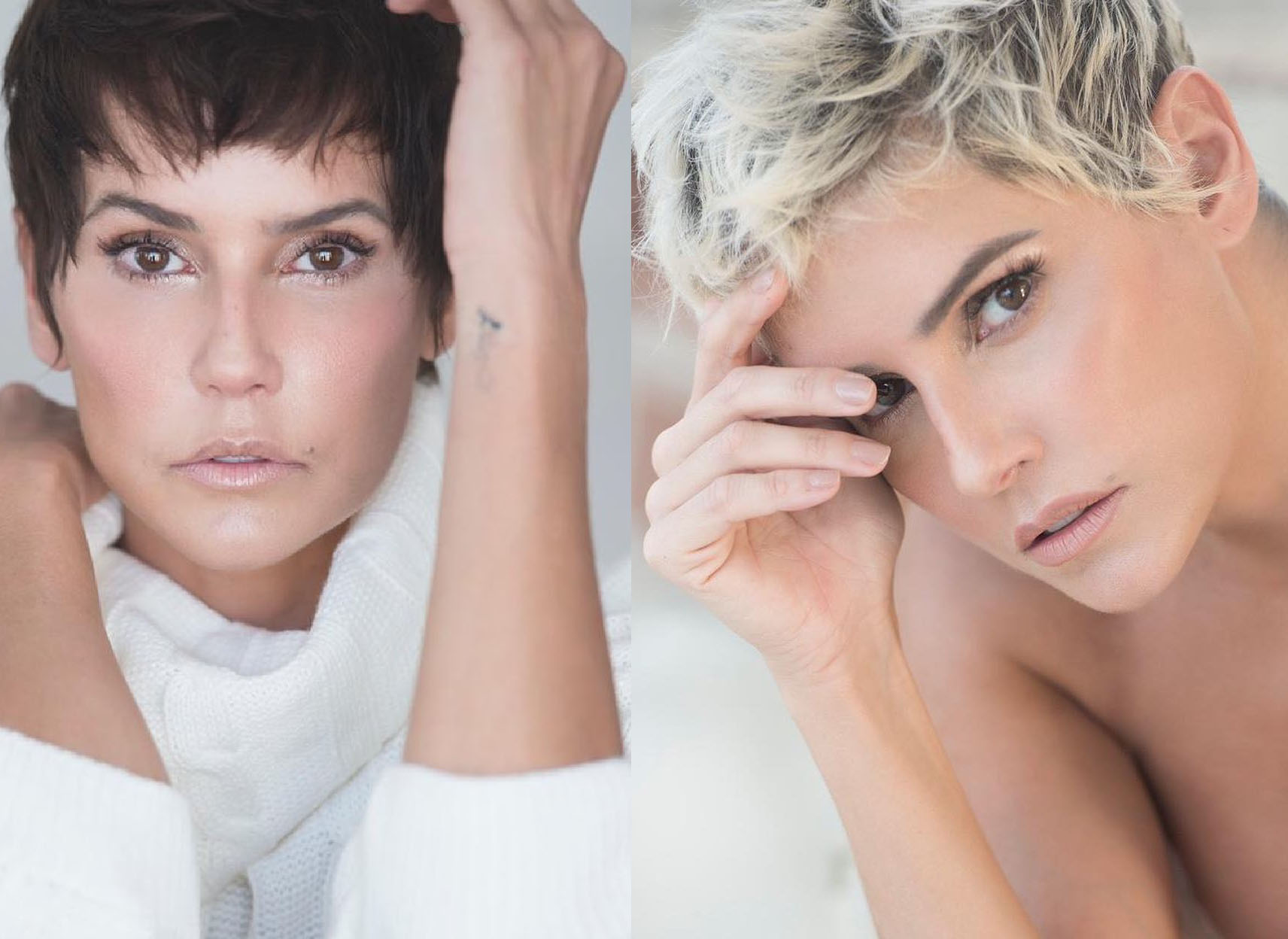 Alopecia Androgenética e Cabelos Curtos: Como o Corte Pode Ajudar no Volume e Estilo