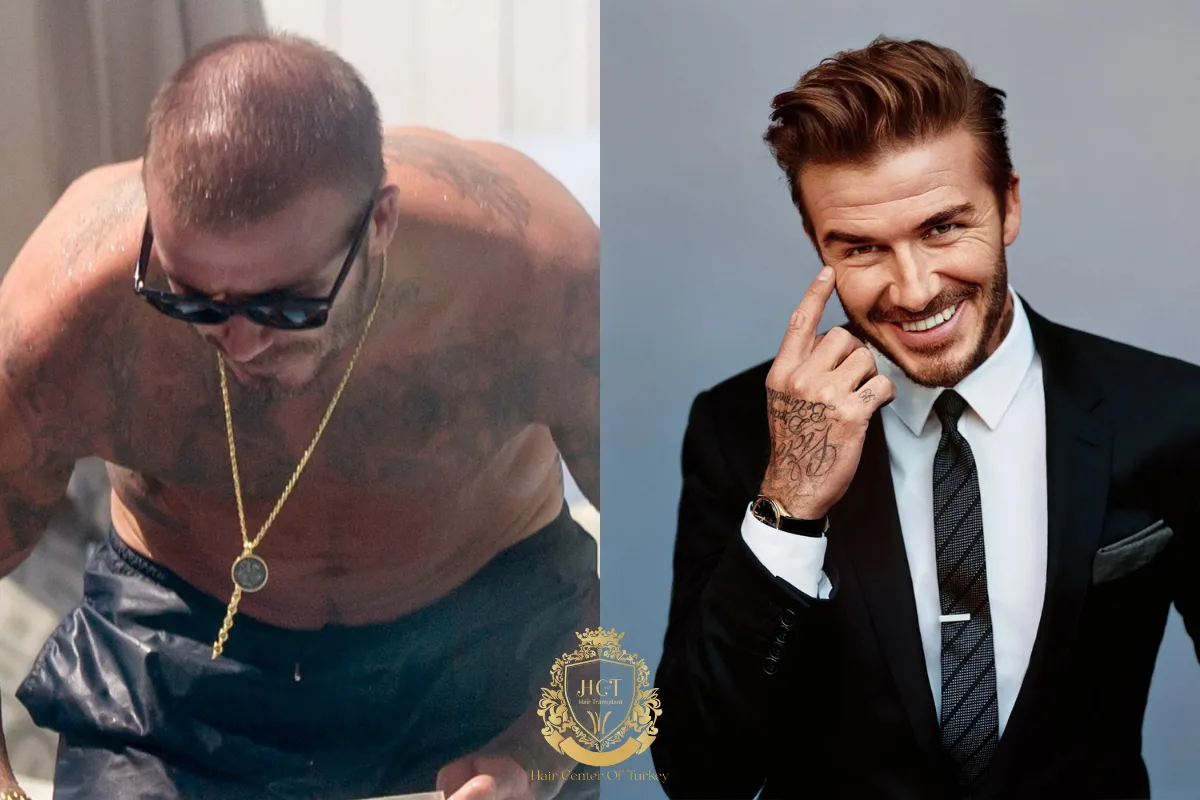 david beckham cabelo