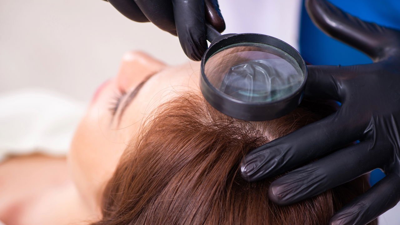 IA para saúde capilar