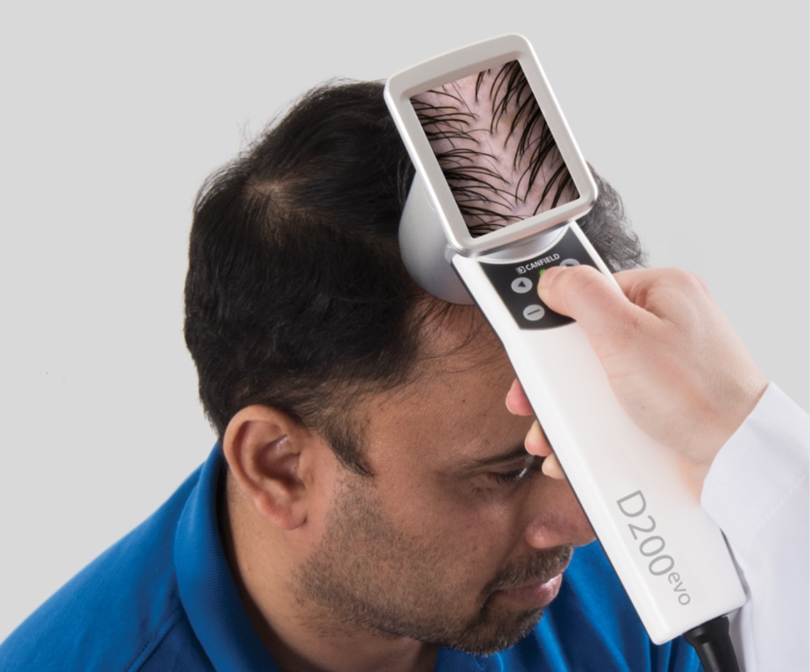 Análise de couro cabeludo com inteligência artificial