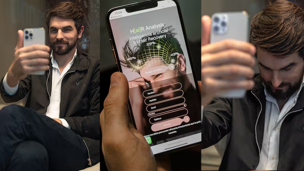 Diagnóstico de queda de cabelo por IA