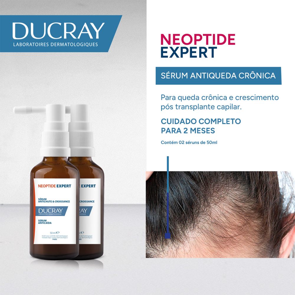ducray neoptide expert onde comprar