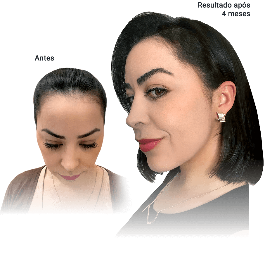 Equipe médica especializada em transplante feminino