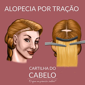 Como identificar e prevenir a alopecia de tração: Guia completo; Os melhores tratamentos para alopecia de tração: Opções e resultados; Tricologia em São Paulo: Encontre o especialista ideal para sua saúde capilar; Penteados que causam alopecia de tração: Evite danos aos seus fios; Diferença entre alopecia de tração reversível e irreversível: O que você precisa saber; Mitos e verdades sobre a queda de cabelo por tração