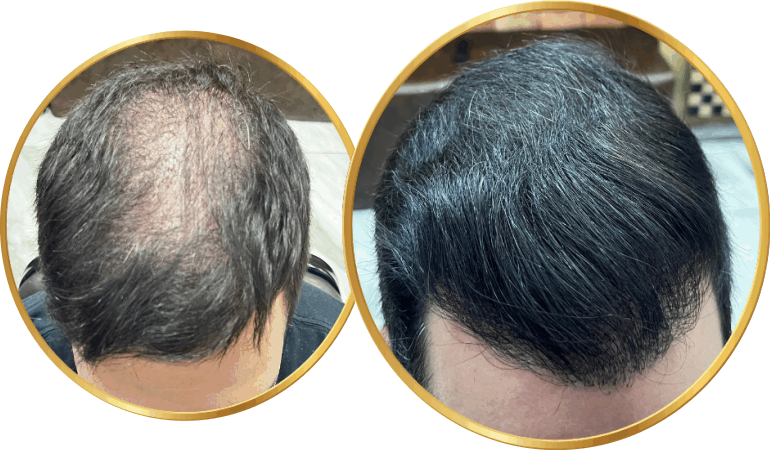 Guia Completo de Tricologistas em Novo Hamburgo