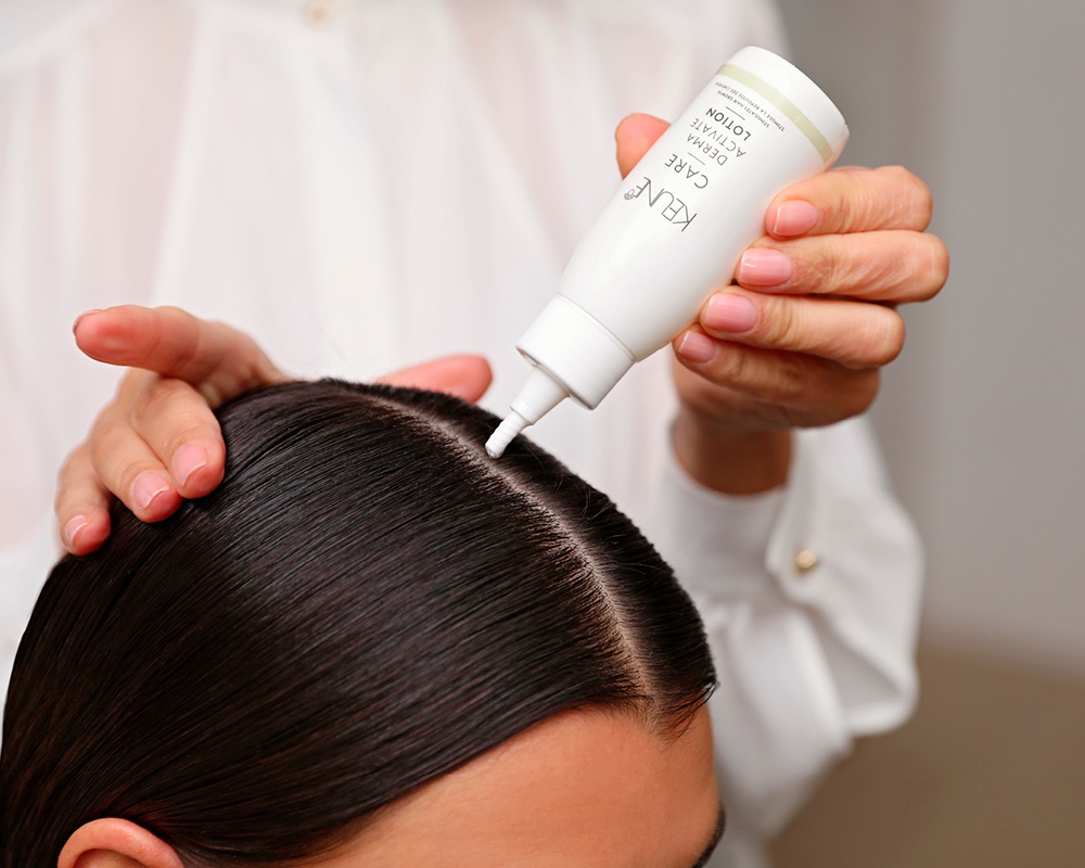 Especialista em saúde do couro cabeludo