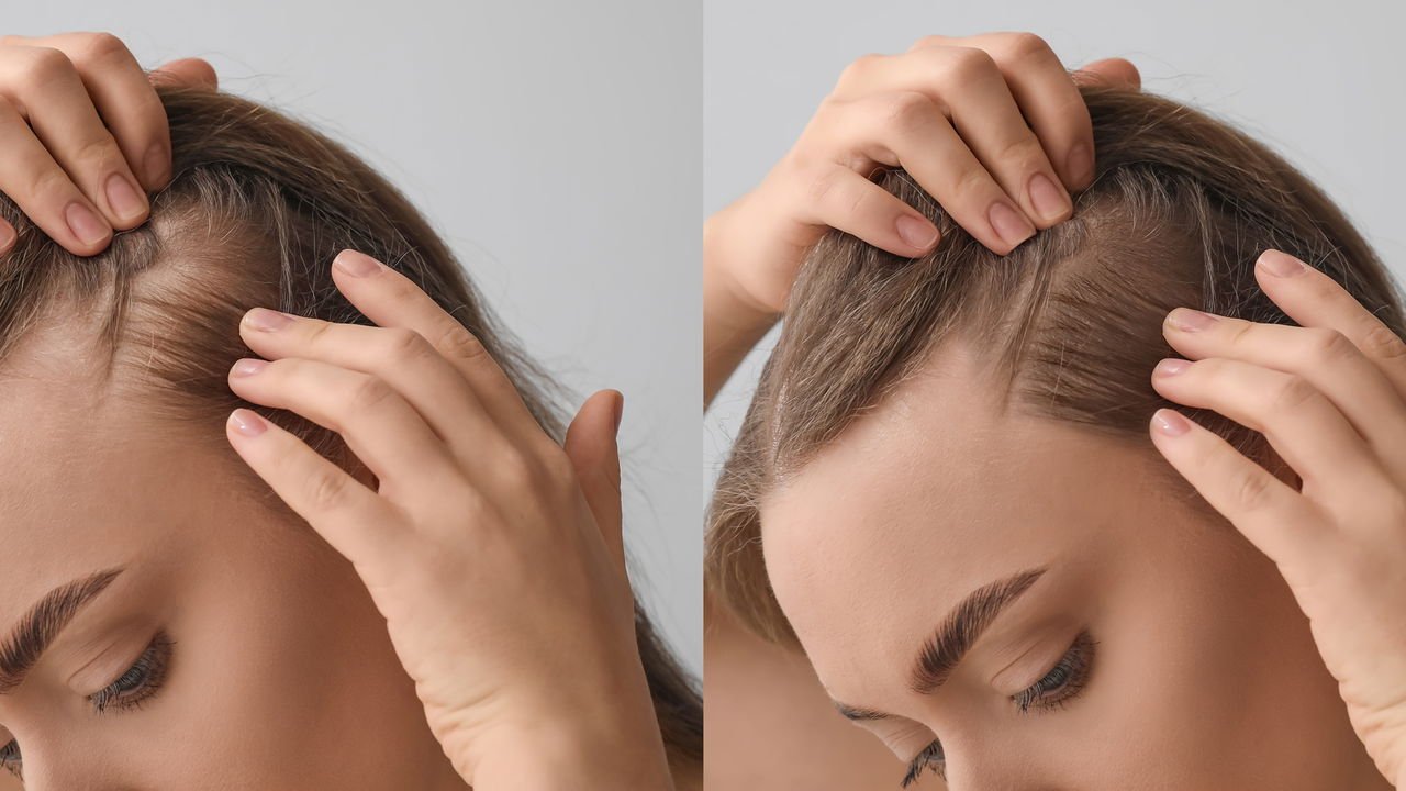 fazer o cabelo crescer