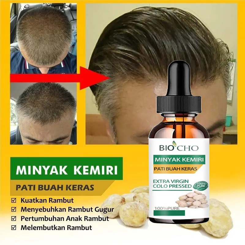 gengibre para crescimento de cabelo rápido