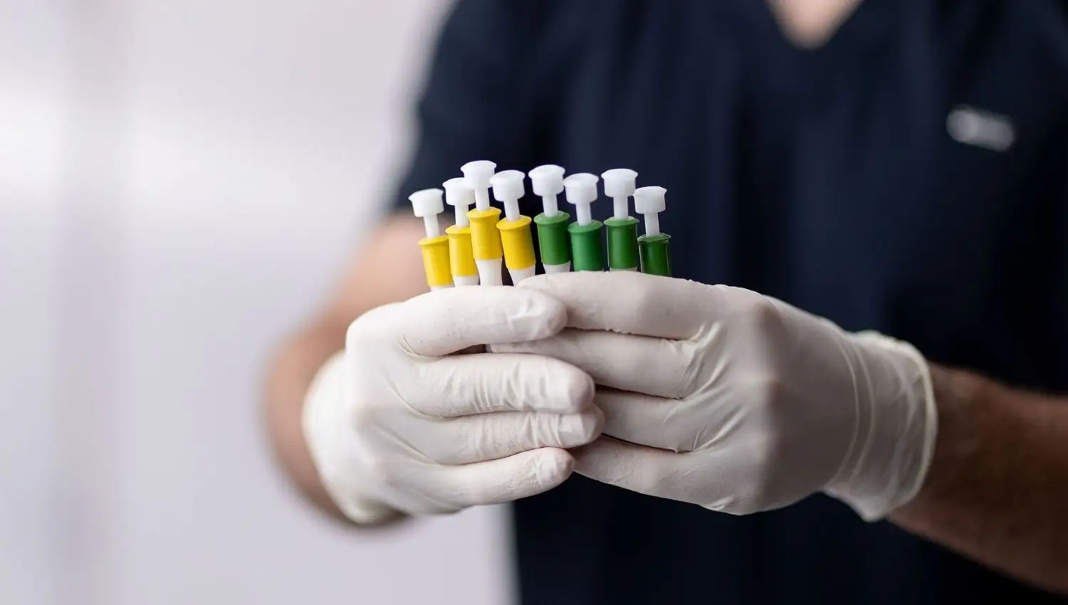 Quanto Custa um Transplante Capilar Feminino em São Paulo?