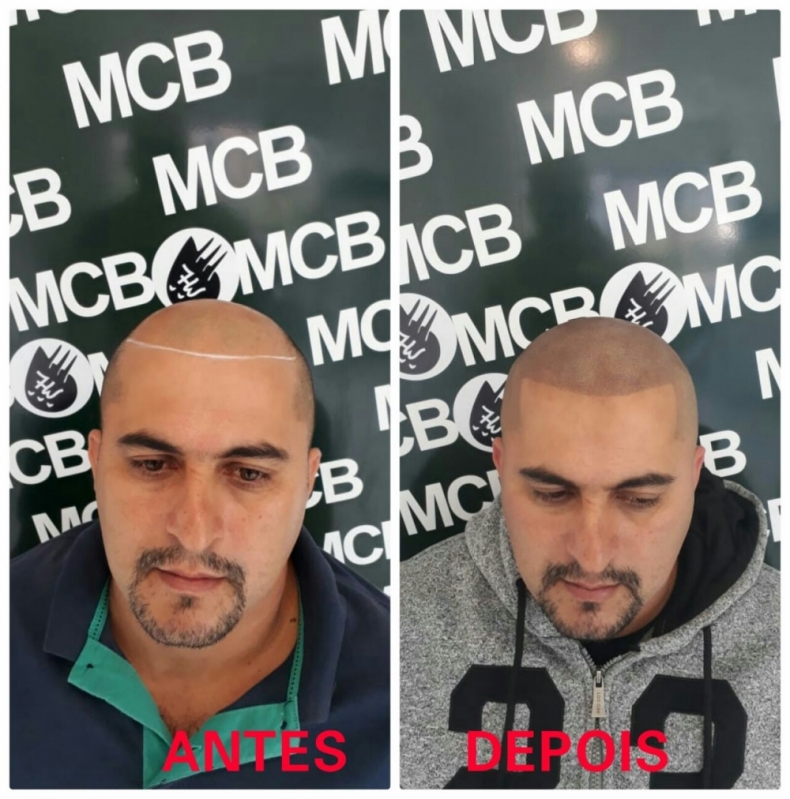 Como Escolher o Mid Fade Perfeito para Seu Tipo de Rosto