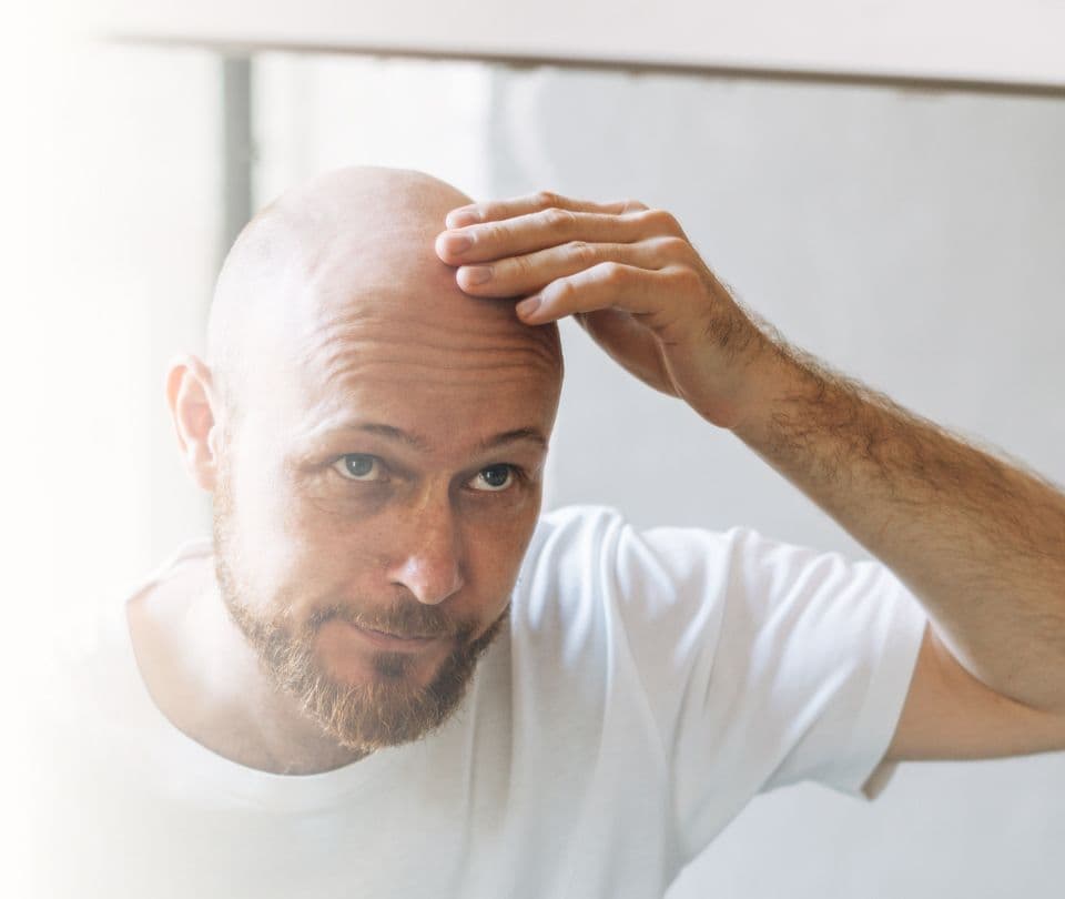 Micropigmentação Capilar Feminina: Solução para Rarefação e Volume