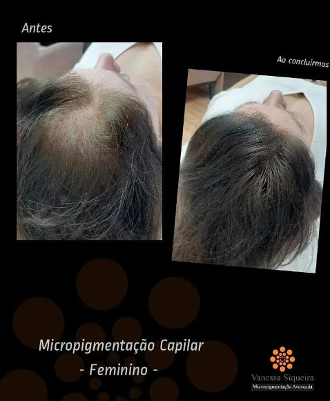 Cuidados Pós-Micropigmentação Capilar: Guia Completo para Maior Durabilidade