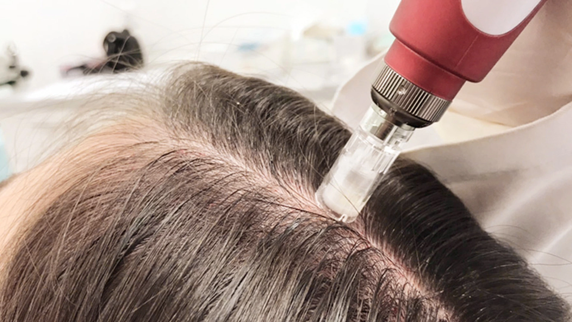 MMP capilar clínica São Paulo