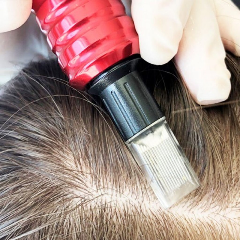 Depoimentos: Resultados Reais do MMP Capilar para Queda de Cabelo