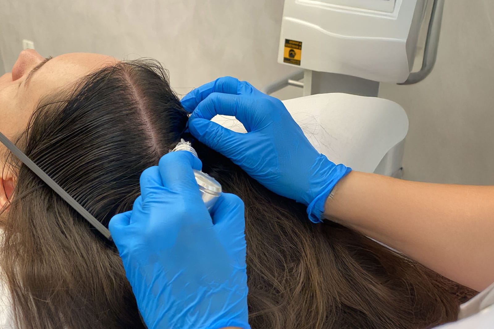 MMP capilar clínica São Paulo