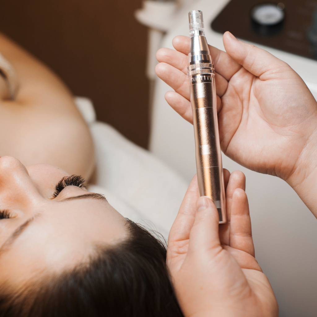 MMP Capilar vs. Microagulhamento: Qual a Melhor Opção para Você?