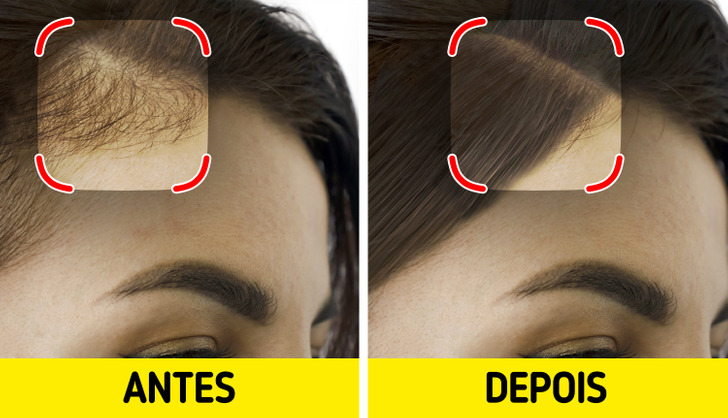 Como Evitar o Cabelo Pesado com Óleo de Coco: Dicas Essenciais