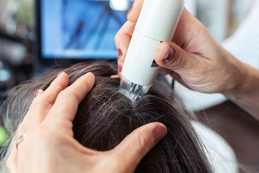 Diferenças entre FUE e FUT no Transplante Capilar Feminino: Qual a Melhor Escolha?