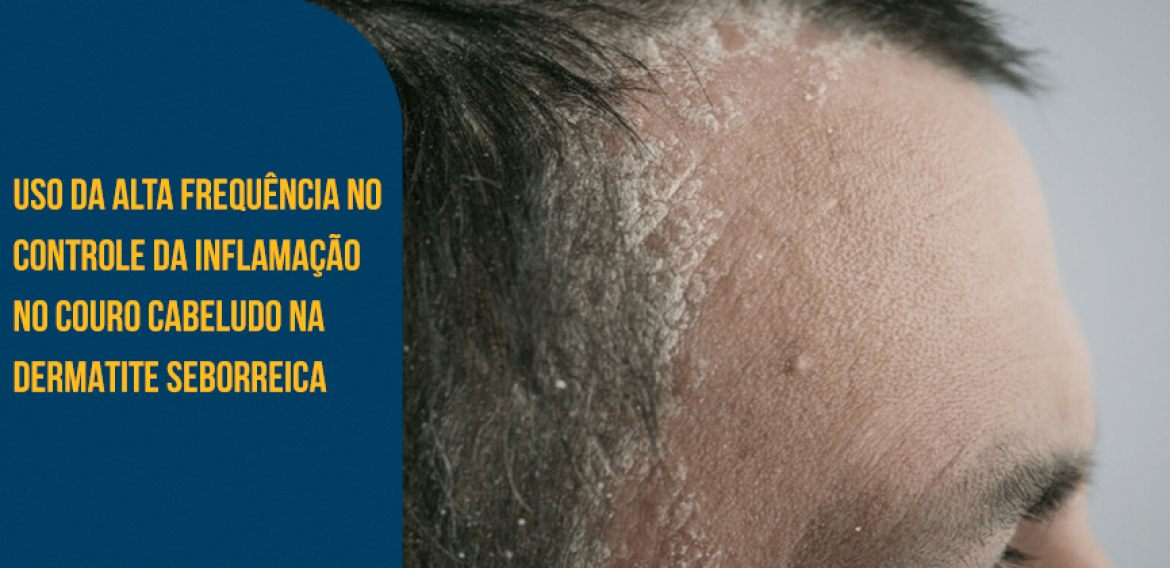 Onde Fazer Ozonioterapia Capilar em Londrina: Preços e Avaliações