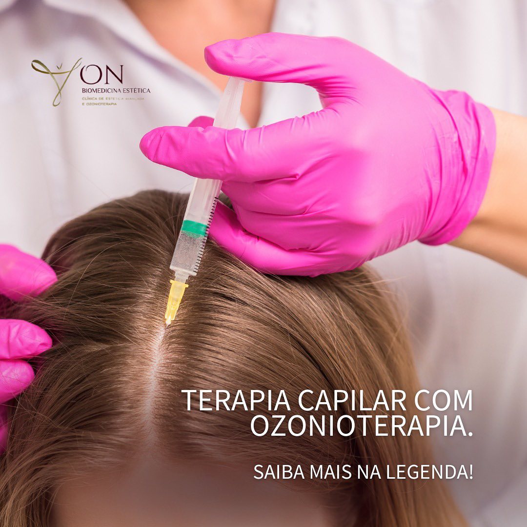 Ozonioterapia Capilar: Contraindicações e Riscos que Você Precisa Saber