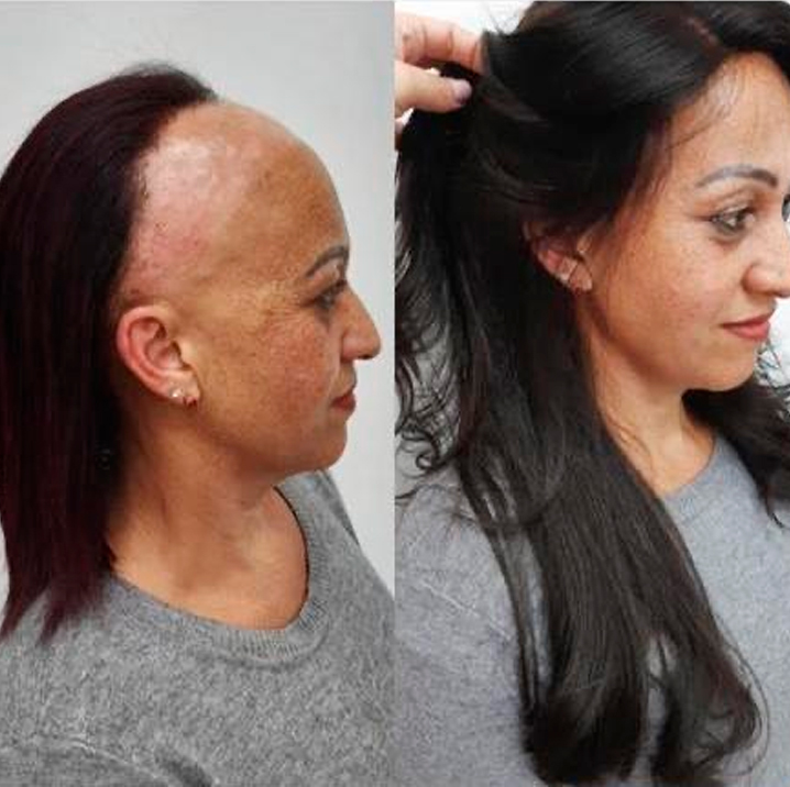 prótese capilar feminina cabelo humano sp