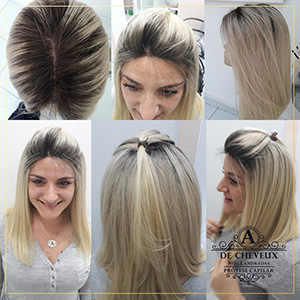 Prótese capilar lace front preço