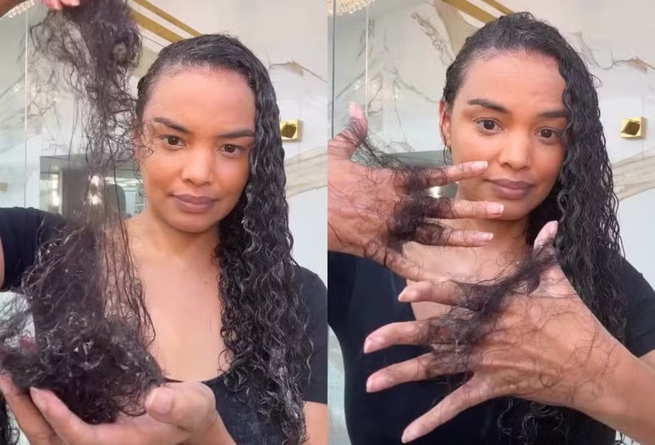 Suplementos Essenciais para Combater a Queda Capilar na Amamentação