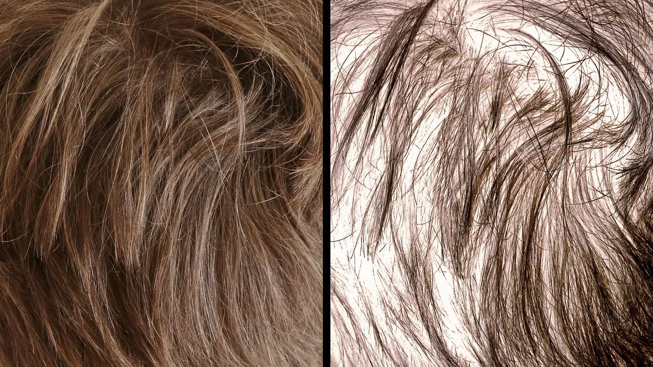 Cronograma capilar para queda: como montar e seguir