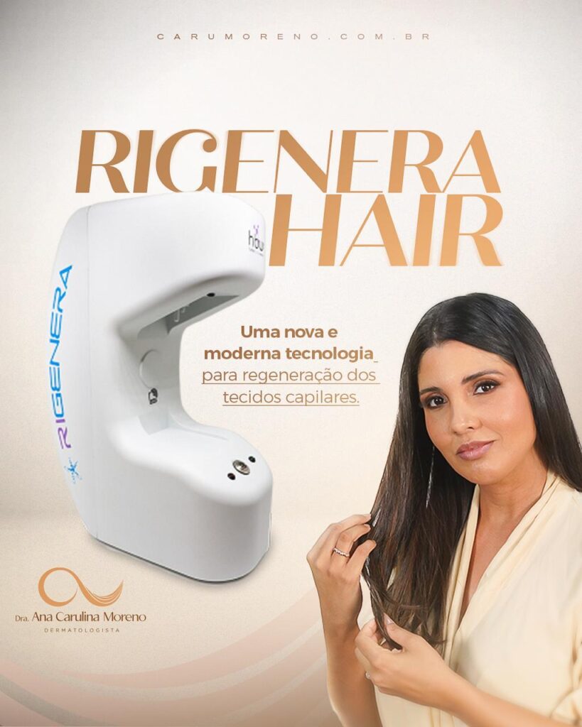 Rigenera Hair: O que esperar nos primeiros meses