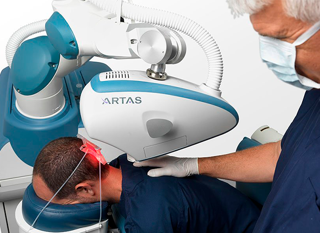 Comparativo: Transplante capilar robótico vs. manual