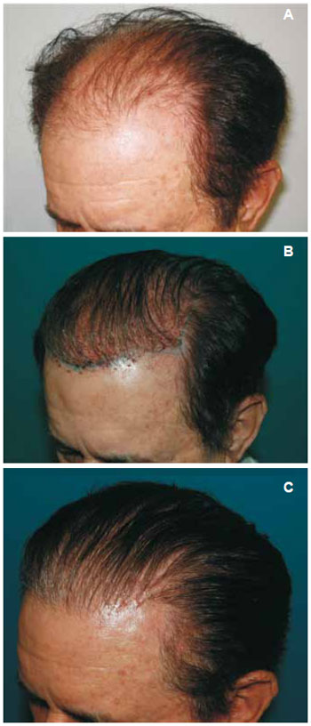 Preview Long Hair: Vale a pena o investimento?