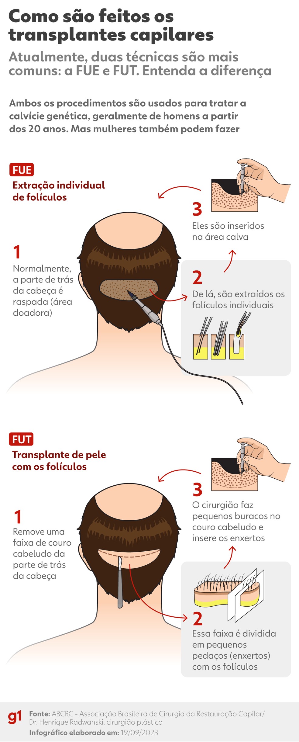1. Transplante Capilar Niterói: Guia Completo de Preços e Clínicas
2. FUE vs FUT: Qual Técnica de Transplante Capilar é Ideal para Você?
3. Fatores que Influenciam o Custo do Transplante Capilar em 2026
4. As Melhores Clínicas de Transplante Capilar em Niterói Avaliadas
5. Recuperação Pós-Transplante Capilar: O Que Esperar?