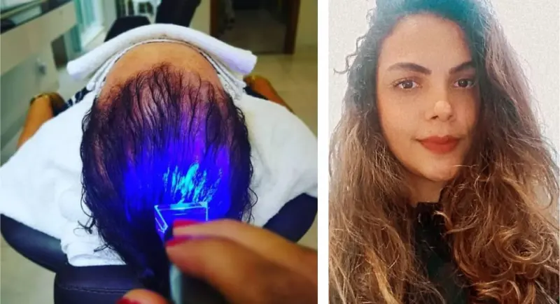 Como Escolher o Melhor Aparelho de LEDterapia Home Care para Seu Tipo de Cabelo