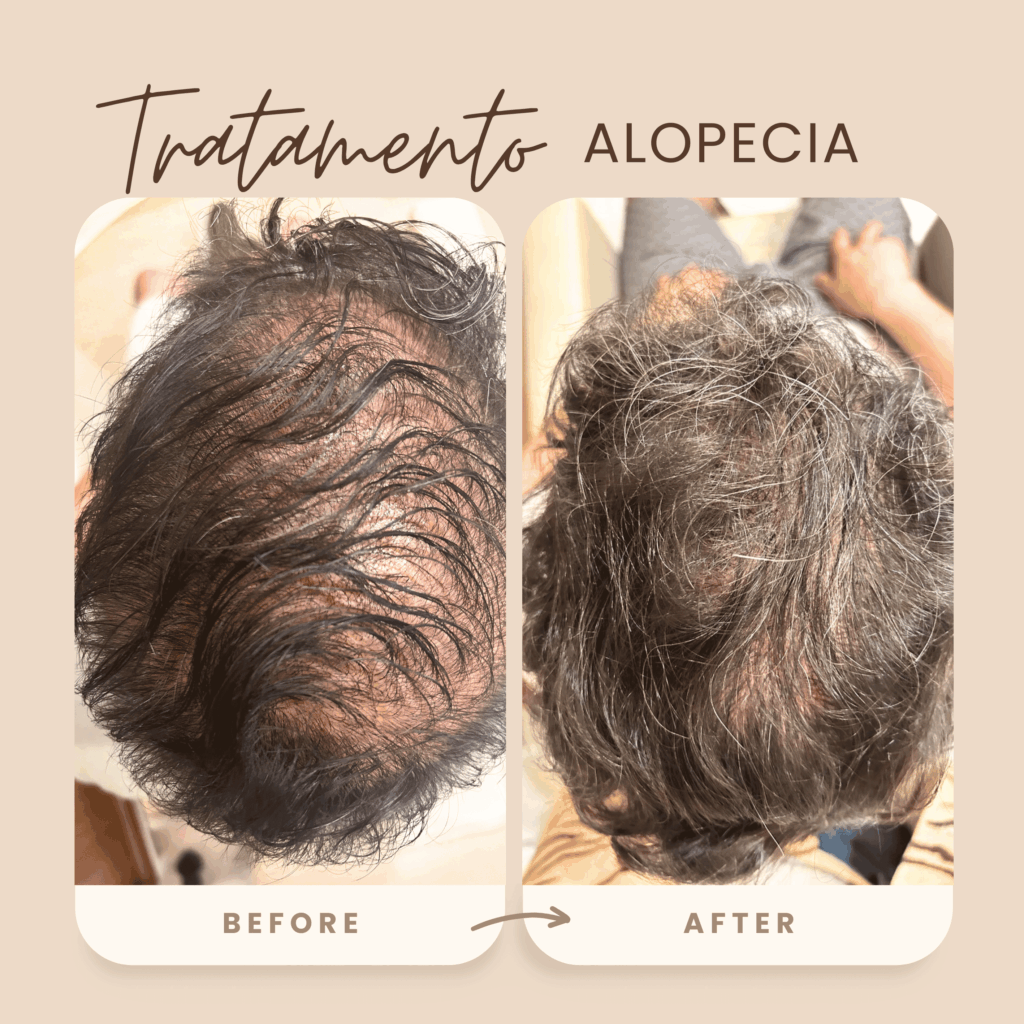 Guia Completo de Clínicas de Tricologia em Olinda