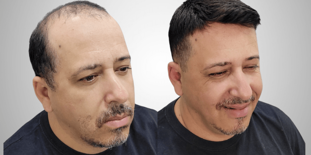 Guia Completo: Como Fazer a Manutenção da Sua Prótese Capilar em Casa